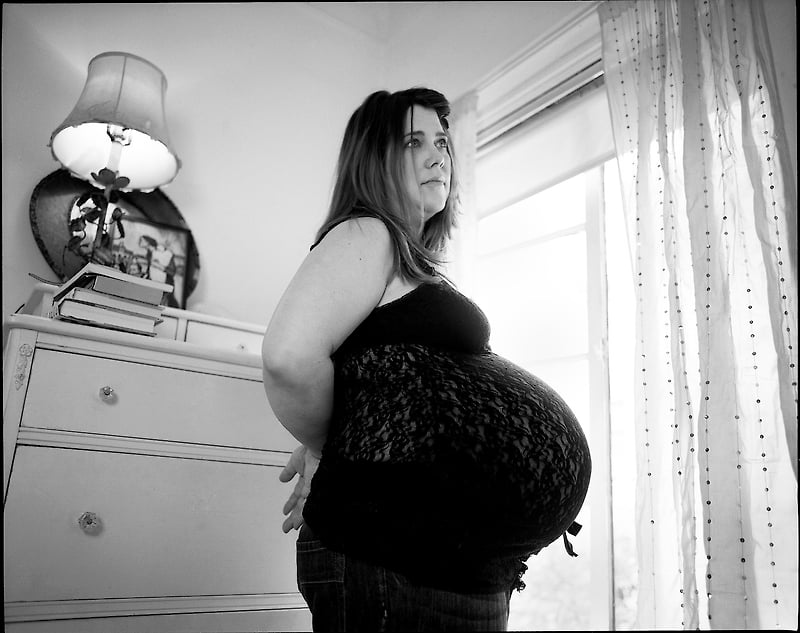 Louise P Preg - M.ESCRIBANO